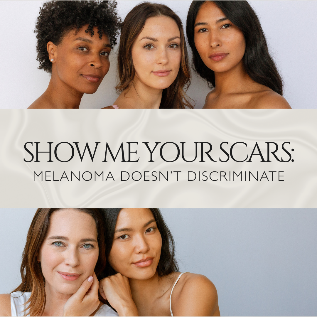 Show Me Your Scars: Melanoma Doesn't Discriminate